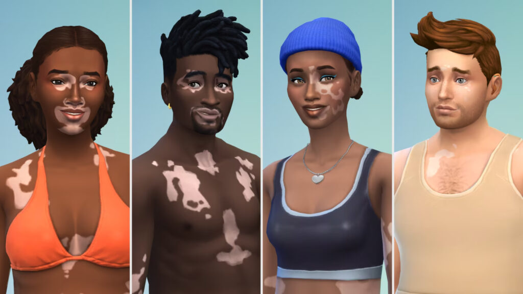 The Sims 4 - novo recurso de pele Vitiligo