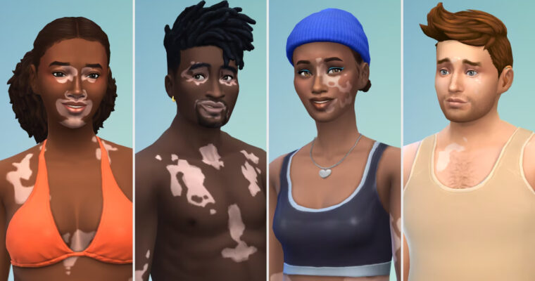 The Sims 4 - novo recurso de pele Vitiligo